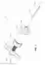 Fig. 03 - Osteotome with a distal portion for simultaneous advancement and articulation
