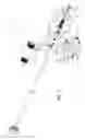 Fig. 06 - Osteotome with a distal portion for simultaneous advancement and articulation