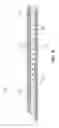 Fig. 09 - Osteotome with a distal portion for simultaneous advancement and articulation