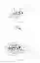 Fig. 22 - Intramedullary nail fixation guides, devices, and methods of use