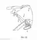 Fig. 08 - Systems, devices, and methods for guiding surgical devices into bone