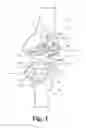 Fig. 02 - Low profile patient specific cutting blocks for a knee joint