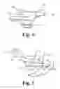 Fig. 04 - Low profile patient specific cutting blocks for a knee joint