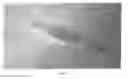 Fig. 06 - BIFURCATED FORCEPS
