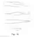 Fig. 08 - BIFURCATED FORCEPS