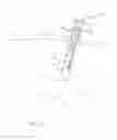 Fig. 41 - DIVERTICULUM INVERTING DEVICE