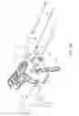 Fig. 71 - Methods and systems for performing a medical procedure