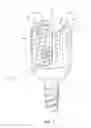 Fig. 02 - Spinal implant system and methods of use