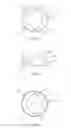 Fig. 04 - Spinal implant system and methods of use