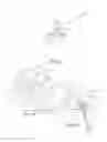 Fig. 08 - Systems and methods for posterior dynamic stabilization of the spine