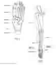Fig. 02 - DEVICES, SYSTEMS, AND METHODS FOR RE-ALIGNMENT OF BONE