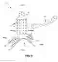 Fig. 04 - Adjustable rib and sternal implant