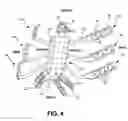 Fig. 05 - Adjustable rib and sternal implant