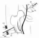 Fig. 01 - TECHNIQUE AND METHOD TO LOCALLY DELIVER OBJECTS INTO BONE