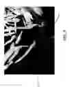 Fig. 06 - Milled bone graft materials and methods of use