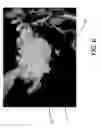Fig. 07 - Milled bone graft materials and methods of use