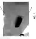 Fig. 08 - Milled bone graft materials and methods of use