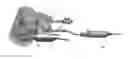 Fig. 01 - Transperineal vapor ablation systems and methods