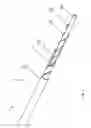 Fig. 02 - Selective stiffening catheter