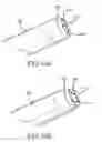 Fig. 08 - Device and method of ablative cutting with helical tip