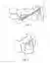 Fig. 02 - ADJUSTABLE WIRE HOOK FOR ORTHODONTIC ELASTICS