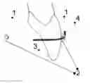Fig. 01 - Orthodontic system and method of use