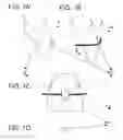 Fig. 02 - Orthodontic system and method of use