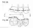 Fig. 07 - Orthodontic system and method of use