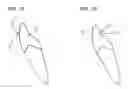 Fig. 08 - Orthodontic system and method of use
