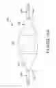 Fig. 26 - ATRAUMATIC MEDICAL DEVICE ANCHORING AND DELIVERY SYSTEM WITH ENHANCED ANCHORING