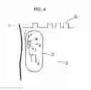 Fig. 05 - System for controlling an implantable device on the basis of commands issued by a user