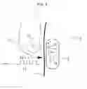 Fig. 06 - System for controlling an implantable device on the basis of commands issued by a user
