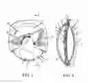 Fig. 02 - Intraocular Cell Migration Inhibition System