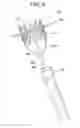Fig. 07 - Multi-component designs for heart valve retrieval device, sealing structures and stent assembly