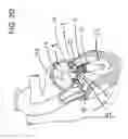 Fig. 06 - Transcatheter atrio-ventricular valve prosthesis