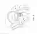 Fig. 08 - Transcatheter atrio-ventricular valve prosthesis