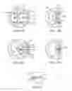 Fig. 03 - Location, time, and/or pressure determining devices, systems, and methods for deployment of lesion-excluding heart implants for treatment of cardiac heart failure and other disease states