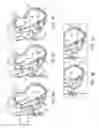 Fig. 05 - Location, time, and/or pressure determining devices, systems, and methods for deployment of lesion-excluding heart implants for treatment of cardiac heart failure and other disease states