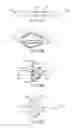 Fig. 07 - Location, time, and/or pressure determining devices, systems, and methods for deployment of lesion-excluding heart implants for treatment of cardiac heart failure and other disease states