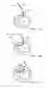 Fig. 10 - Location, time, and/or pressure determining devices, systems, and methods for deployment of lesion-excluding heart implants for treatment of cardiac heart failure and other disease states