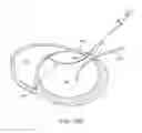 Fig. 17 - Location, time, and/or pressure determining devices, systems, and methods for deployment of lesion-excluding heart implants for treatment of cardiac heart failure and other disease states