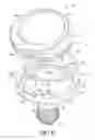 Fig. 17 - Adjustable orthopedic connections