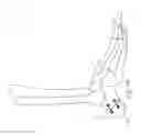 Fig. 17 - Orthopedic fasterners, instruments and methods