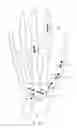 Fig. 18 - Orthopedic fasterners, instruments and methods