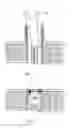 Fig. 32 - Orthopedic fasterners, instruments and methods