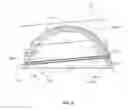 Fig. 04 - ARTICULAR SURFACE REPAIR