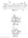 Fig. 07 - Methods of fusing a sacroiliac joint with a fluted screw delivered across the sacroiliac joint