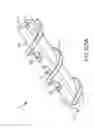 Fig. 112 - Methods of fusing a sacroiliac joint with a fluted screw delivered across the sacroiliac joint