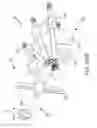 Fig. 119 - Methods of fusing a sacroiliac joint with a fluted screw delivered across the sacroiliac joint