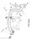 Fig. 149 - Methods of fusing a sacroiliac joint with a fluted screw delivered across the sacroiliac joint